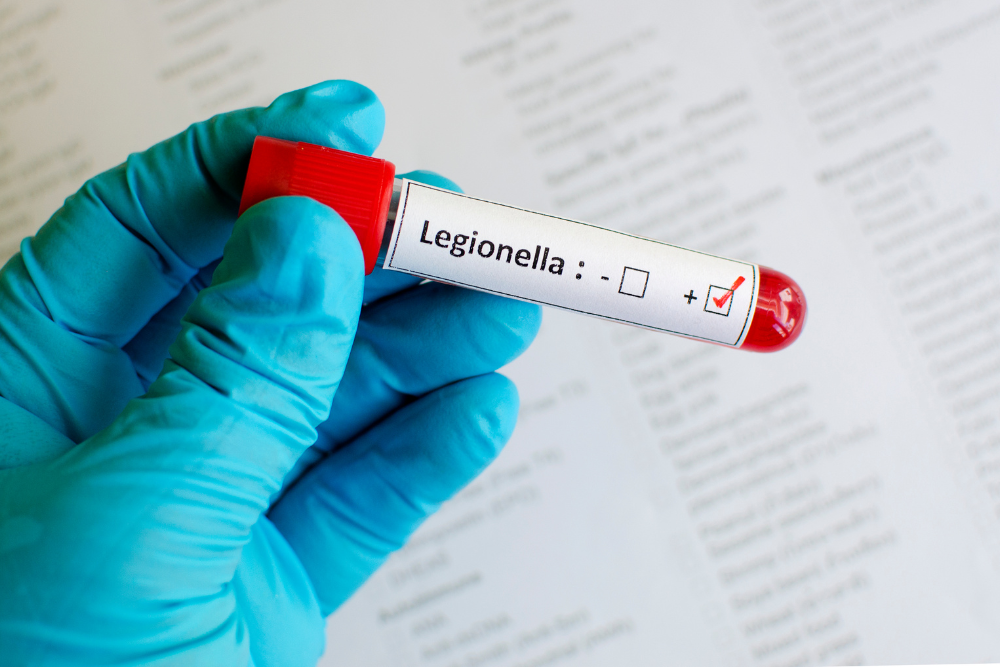 masqueplagas-plan-de-control-legionella